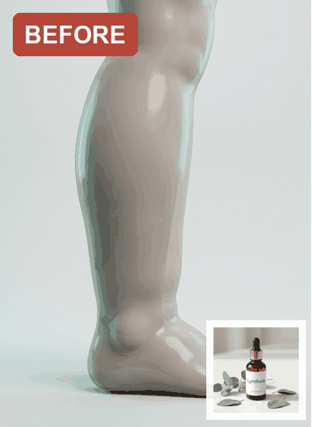 Before and after — less swollen calves